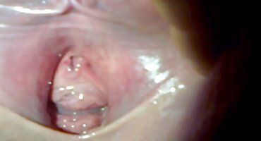 ఆసుపత్రిలో, సెక్స్ ఫిలిం తెలుగు మేజోళ్ళు లో లాటిన ఒక యువ రోగి యొక్క ఆత్మవిశ్వాసం పై దూకి